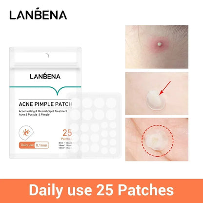 Labéna Akne-Pickel-Patch, 25 Stück, für den täglichen Gebrauch, unsichtbare Akne-Aufkleber, Makel-Behandlung, Akne-Concealer, Make-up