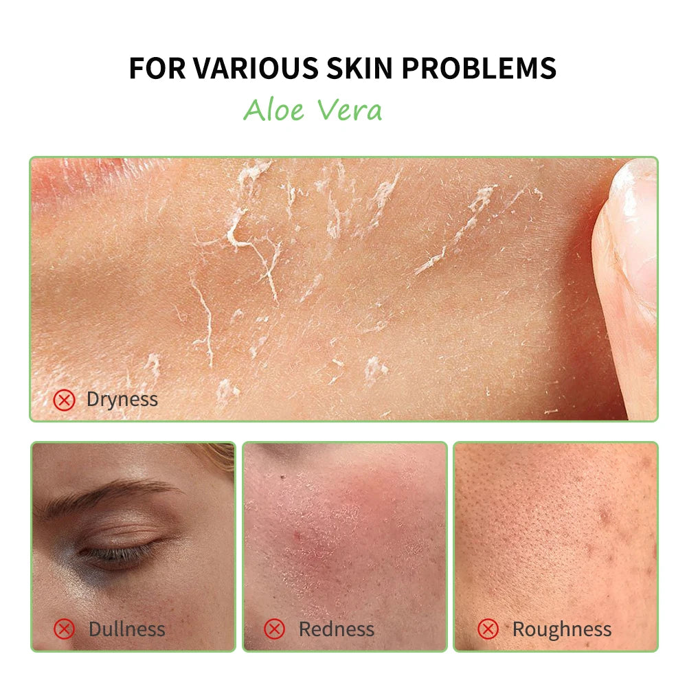 Multi-Hautpflege Aloe Vera Hautpflegeset Tiefenfeuchtigkeitsspendende Tiefenpflege Aufhellung Aufhellende, feuchtigkeitsspendende, glatte Haut